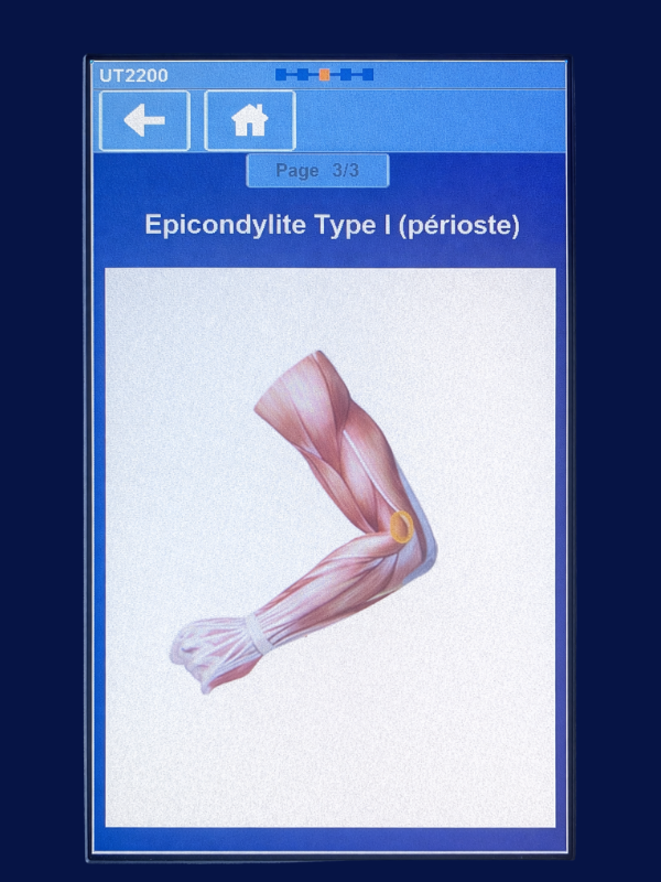 tendinite calcifiante ultrasons