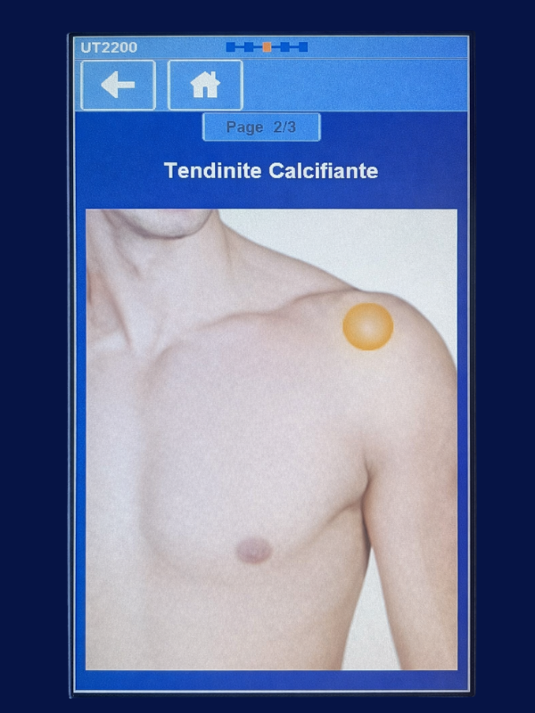 tendinite calcifiante ultrasons