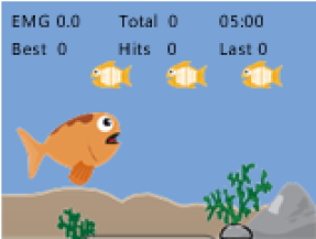Jeu rééducation pelvienne - gros poisson : contraction rapide et réflexe
